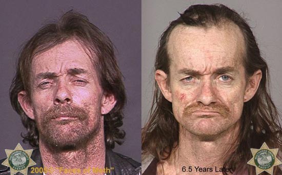 Άνθρωποι πριν και μετά την χρήση ναρκωτικών (3)