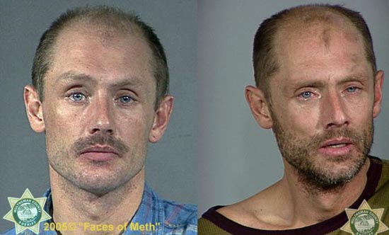 Άνθρωποι πριν και μετά την χρήση ναρκωτικών (5)