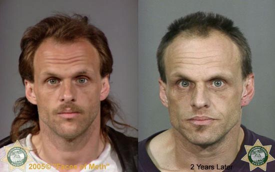 Άνθρωποι πριν και μετά την χρήση ναρκωτικών (6)