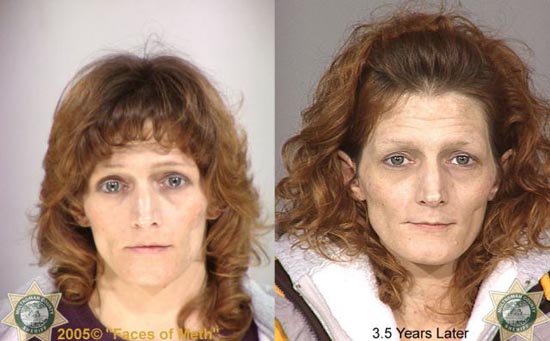 Άνθρωποι πριν και μετά την χρήση ναρκωτικών (8)