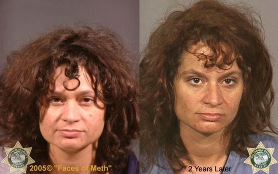 Άνθρωποι πριν και μετά την χρήση ναρκωτικών (11)