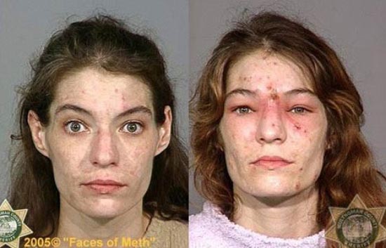Άνθρωποι πριν και μετά την χρήση ναρκωτικών (14)