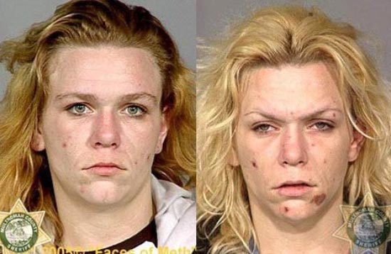 Άνθρωποι πριν και μετά την χρήση ναρκωτικών (15)