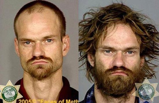 Άνθρωποι πριν και μετά την χρήση ναρκωτικών (16)
