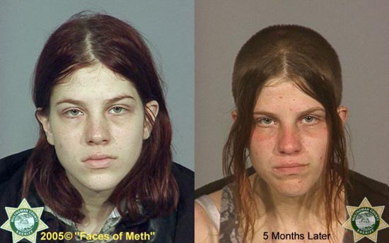 Άνθρωποι πριν και μετά την χρήση ναρκωτικών (17)