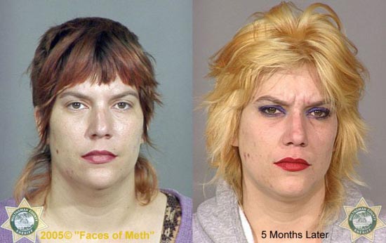 Άνθρωποι πριν και μετά την χρήση ναρκωτικών (4)
