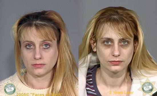 Άνθρωποι πριν και μετά την χρήση ναρκωτικών (13)