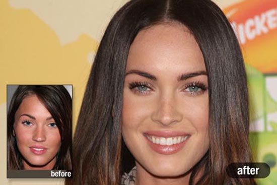 Celebrities πριν και μετά την πλαστική (3)