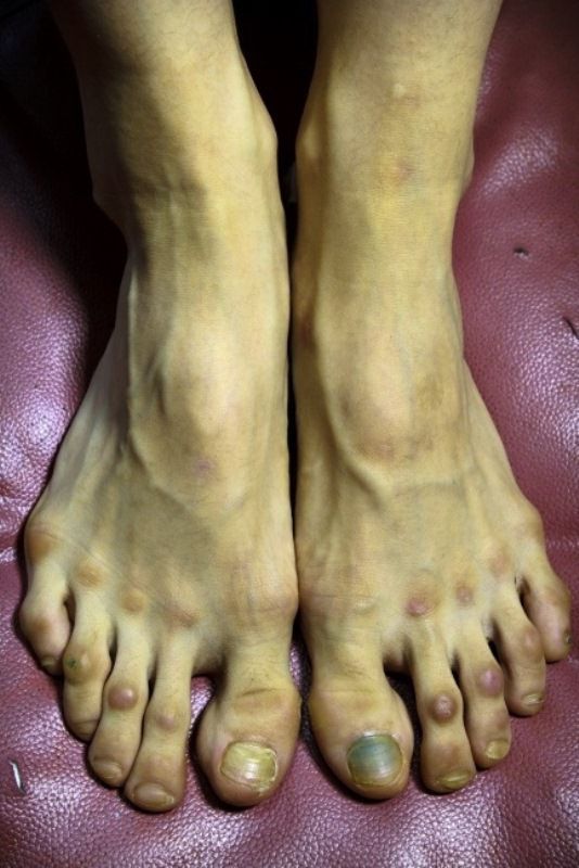 Τα πόδια μιας μπαλαρίνας (2)