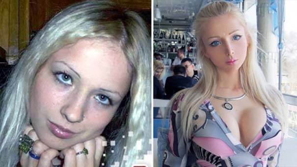 Η γυναίκα Barbie πριν και μετά την μεταμόρφωση (7)
