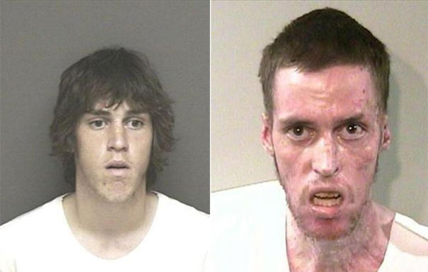 People before and after drug use (4)
