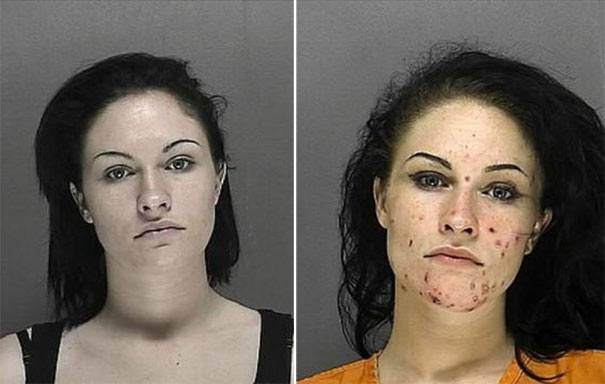 People before and after drug use (5)
