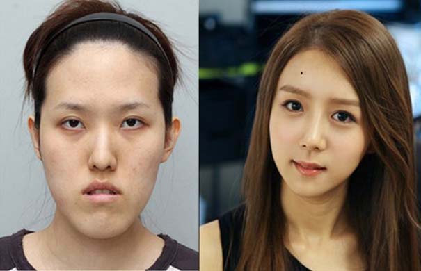 Απίστευτες φωτογραφίες Κορεατών πριν και μετά την πλαστική (21)