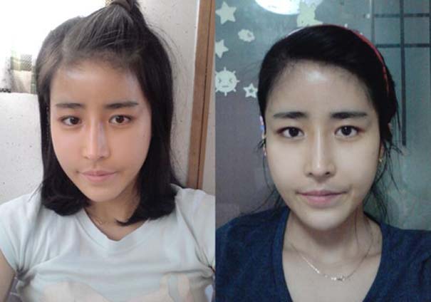 Απίστευτες φωτογραφίες Κορεατών πριν και μετά την πλαστική (22)