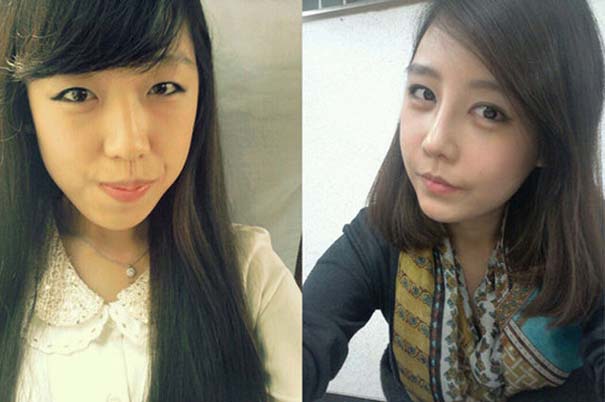 Απίστευτες φωτογραφίες Κορεατών πριν και μετά την πλαστική (24)