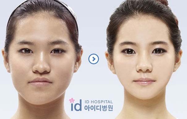 Απίστευτες φωτογραφίες Κορεατών πριν και μετά την πλαστική (27)