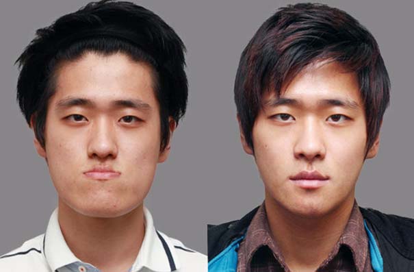 Απίστευτες φωτογραφίες Κορεατών πριν και μετά την πλαστική (29)