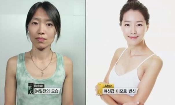 Απίστευτες φωτογραφίες Κορεατών πριν και μετά την πλαστική (34)