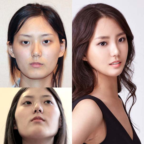 Απίστευτες φωτογραφίες Κορεατών πριν και μετά την πλαστική (37)