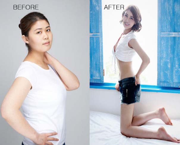 Απίστευτες φωτογραφίες Κορεατών πριν και μετά την πλαστική (44)
