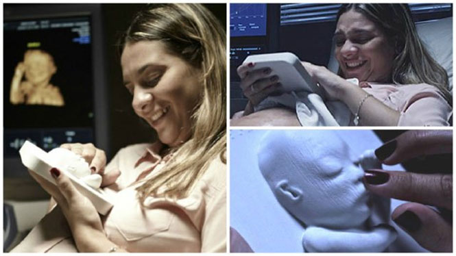 3D εκτυπωμένο υπερηχογράφημα εμβρύου για τυφλή μητέρα | Φωτογραφία της ημέρας
