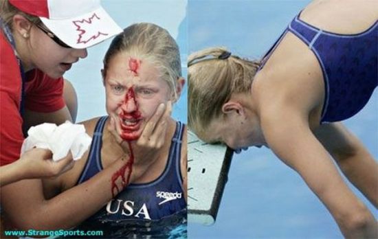 Worst Sports Accidents