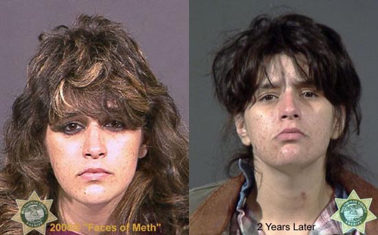 Άνθρωποι πριν και μετά την χρήση ναρκωτικών (2)