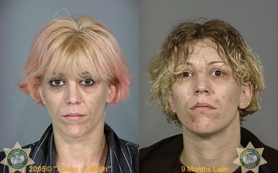 Άνθρωποι πριν και μετά την χρήση ναρκωτικών (19)