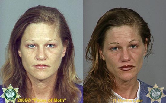 Άνθρωποι πριν και μετά την χρήση ναρκωτικών (11)