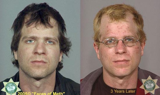 Άνθρωποι πριν και μετά την χρήση ναρκωτικών (12)