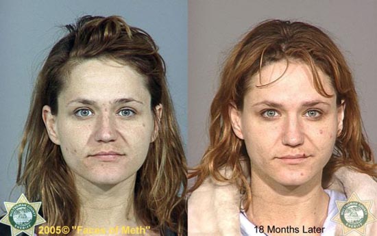 Άνθρωποι πριν και μετά την χρήση ναρκωτικών (18)
