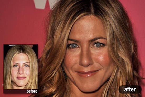 Celebrities πριν και μετά την πλαστική (1)