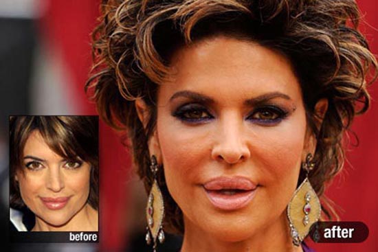 Celebrities πριν και μετά την πλαστική (6)