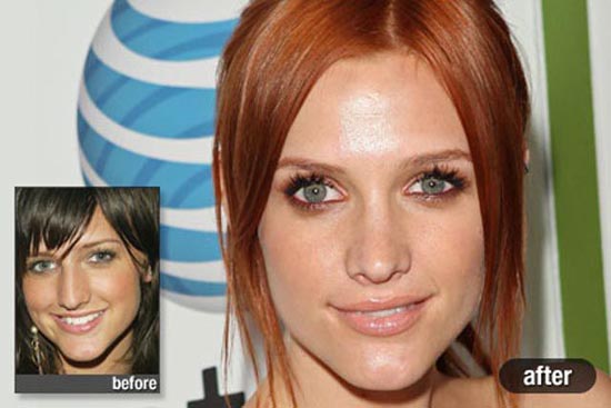 Celebrities πριν και μετά την πλαστική (7)
