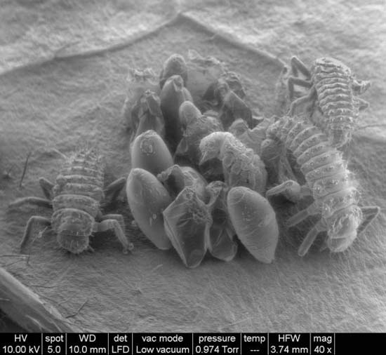 Εκπληκτικές εικόνες από μικροσκόπιο (5)