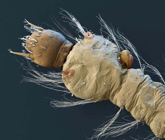 Εκπληκτικές εικόνες από μικροσκόπιο (11)