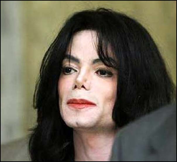 Οι αλλαγές στο πρόσωπο του Michael Jackson με το πέρασμα των χρόνων (16)