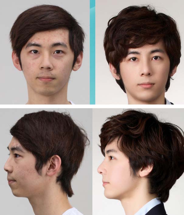 Απίστευτες φωτογραφίες Κορεατών πριν και μετά την πλαστική (5)