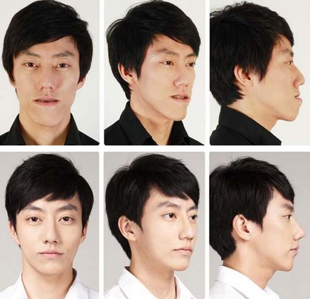 Απίστευτες φωτογραφίες Κορεατών πριν και μετά την πλαστική (20)