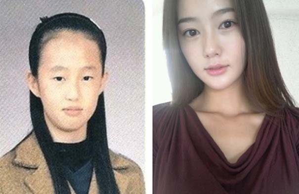 Απίστευτες φωτογραφίες Κορεατών πριν και μετά την πλαστική (25)