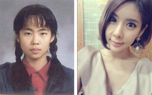 Απίστευτες φωτογραφίες Κορεατών πριν και μετά την πλαστική (26)