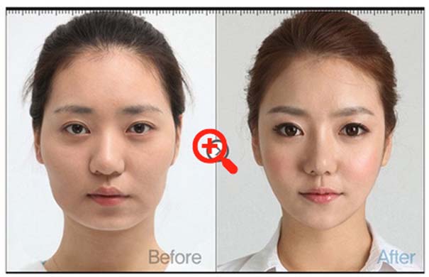 Απίστευτες φωτογραφίες Κορεατών πριν και μετά την πλαστική (29)