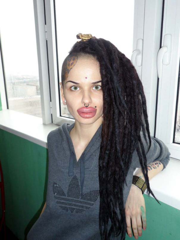 Η γυναίκα με τα μεγαλύτερα χείλη στον κόσμο (2)