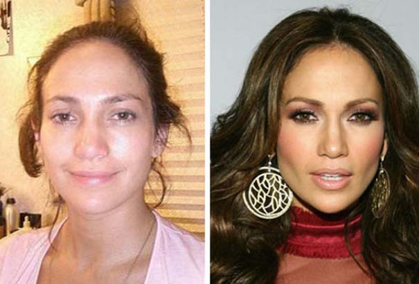 Celebrities πριν και μετά την πλαστική (3)