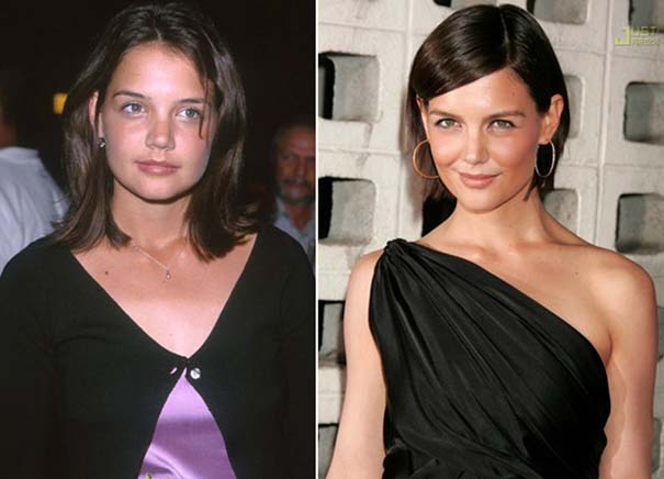 Celebrities πριν και μετά την πλαστική (4)