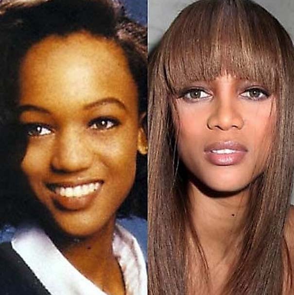 Celebrities πριν και μετά την πλαστική (5)