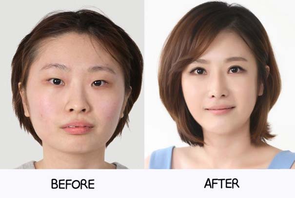 Απίστευτες φωτογραφίες Κορεατών πριν και μετά την πλαστική (9)
