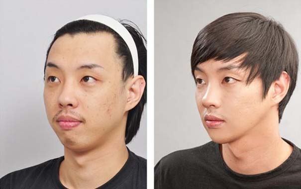 Απίστευτες φωτογραφίες Κορεατών πριν και μετά την πλαστική (18)