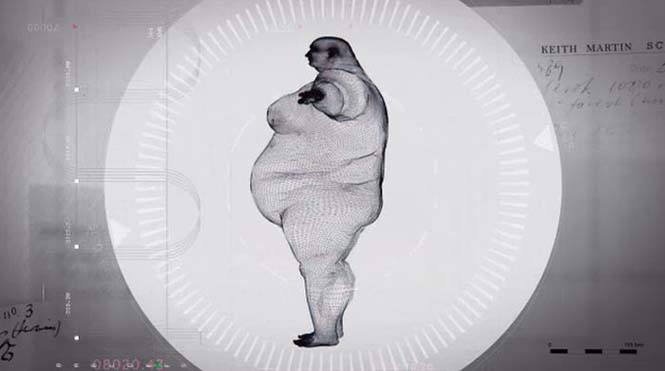 Ακτινογραφίες ανθρώπου 445 κιλών (3)