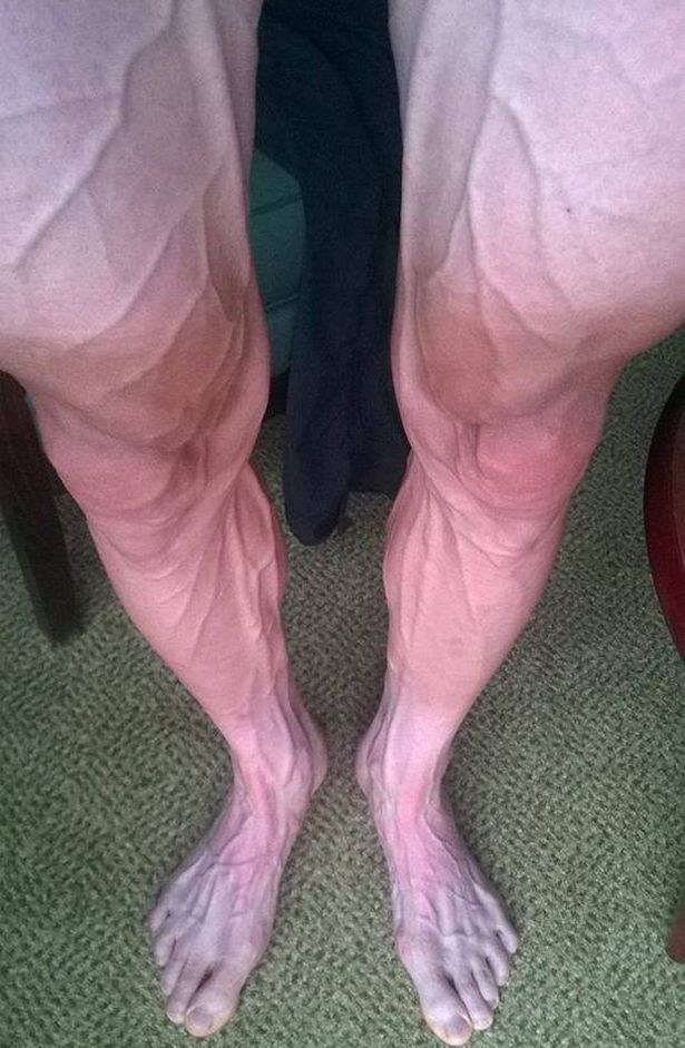 Τα πόδια ενός ποδηλάτη μετά από 250 χλμ στο Tour de France | Φωτογραφία της ημέρας
